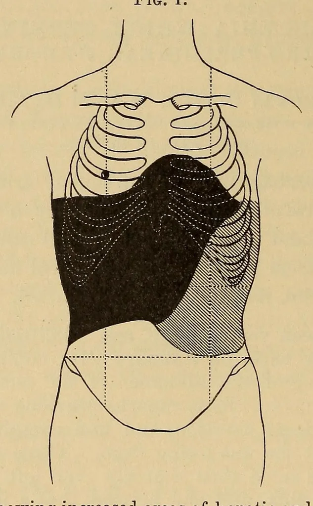 An illustration from The American journal of the medical sciences, 1827, leaf 672
