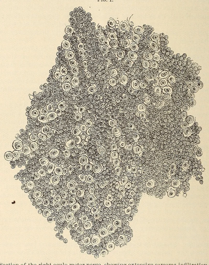 An illustration from The American journal of the medical sciences, 1827, leaf 208