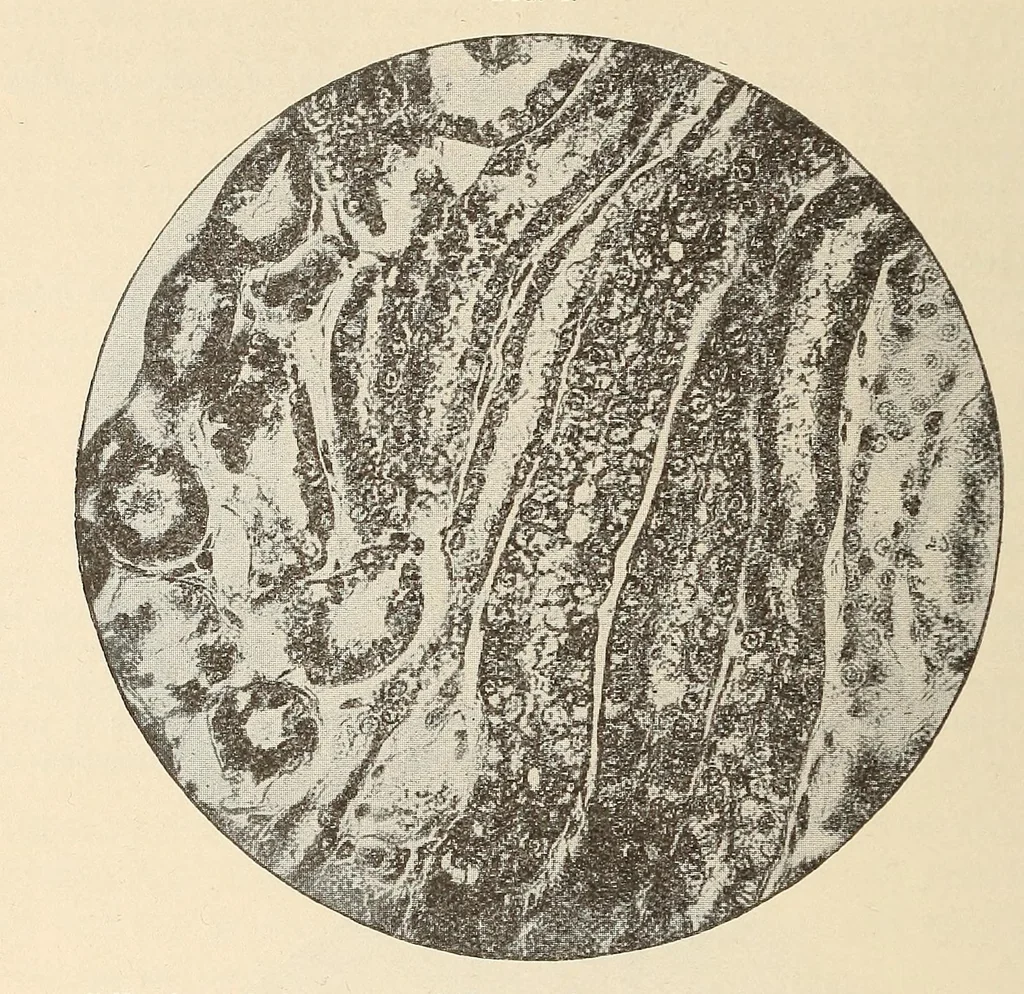 An illustration from The American journal of the medical sciences, 1827, leaf 290