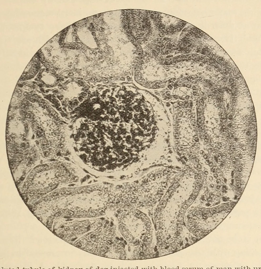 An illustration from The American journal of the medical sciences, 1827, leaf 291