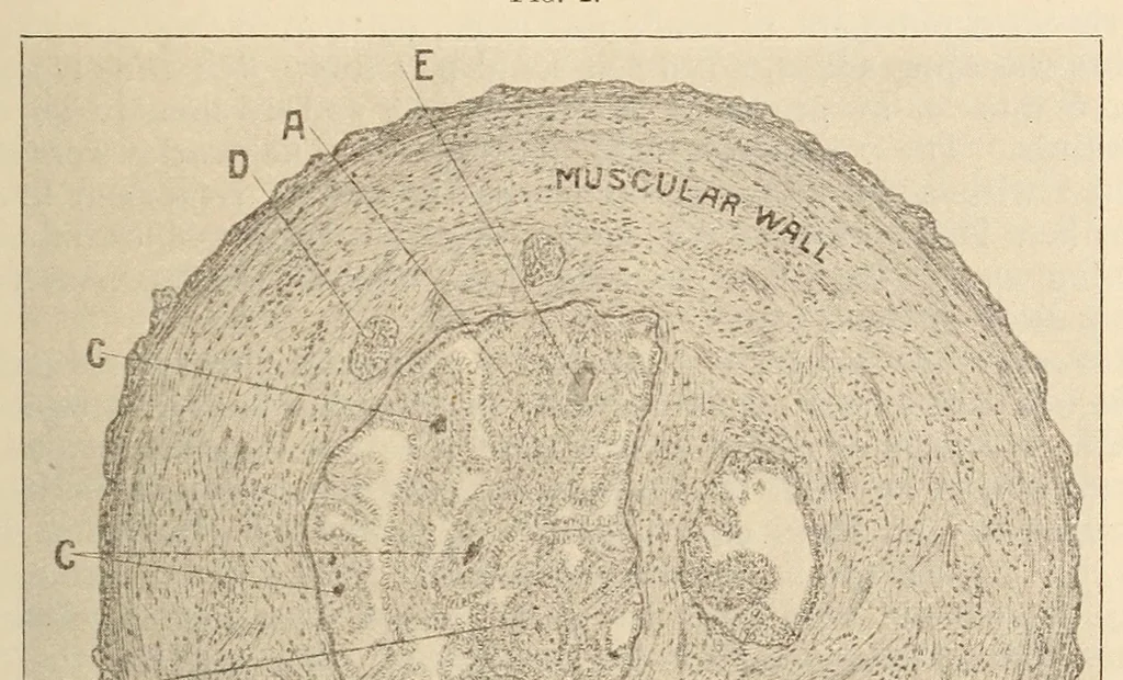An illustration from The American journal of the medical sciences, 1827, leaf 543