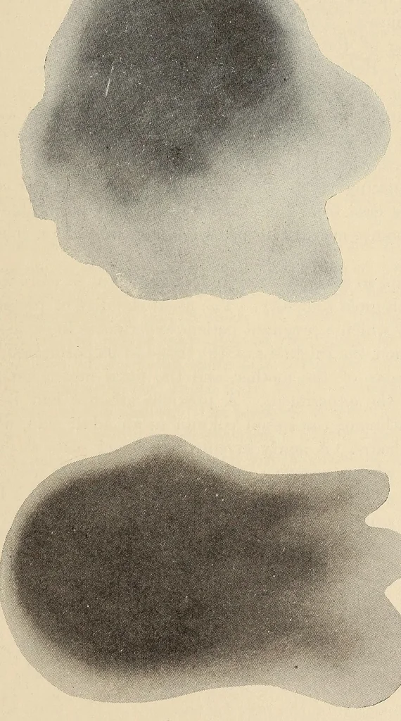 An illustration from The American journal of the medical sciences, 1827, leaf 371