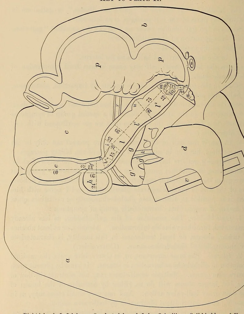 An illustration from The American journal of the medical sciences, 1827, leaf 400