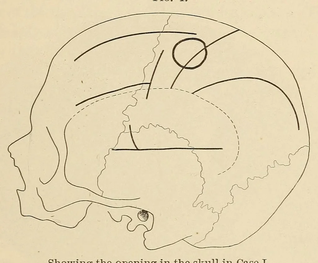 An illustration from The American journal of the medical sciences, 1827, leaf 683