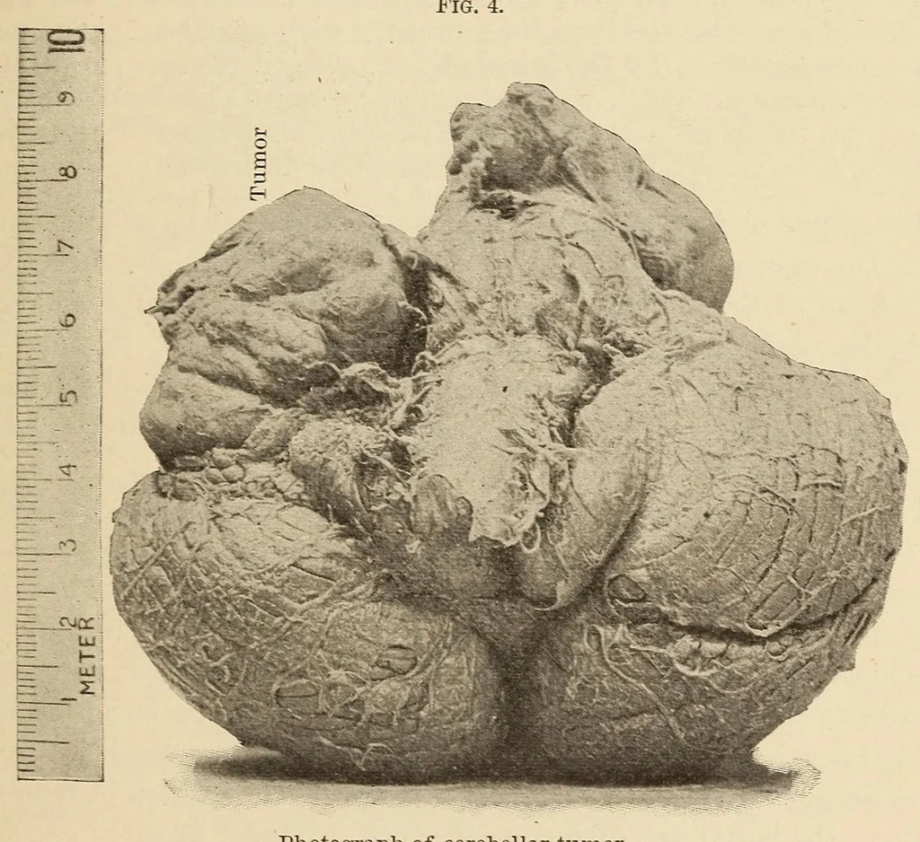 An illustration from The American journal of the medical sciences, 1827, leaf 689