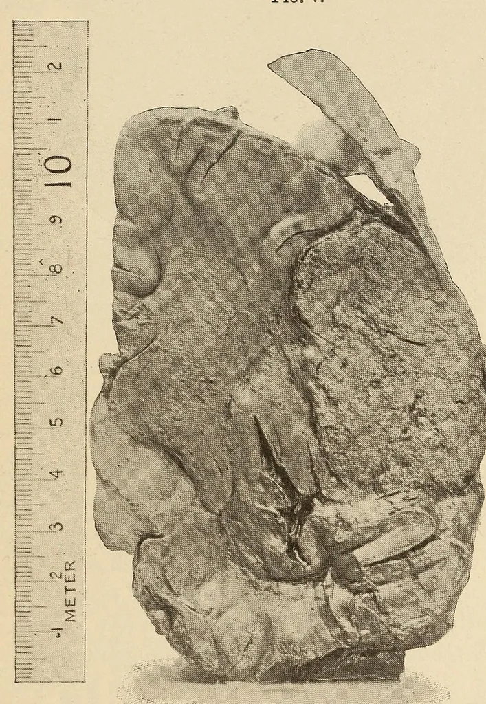 An illustration from The American journal of the medical sciences, 1827, leaf 697
