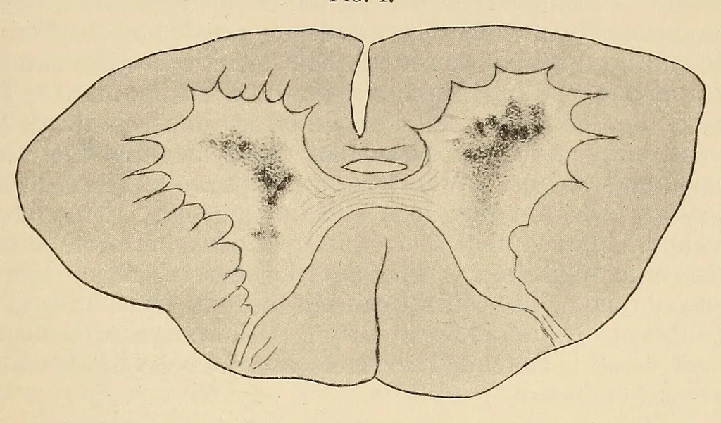 An illustration from The American journal of the medical sciences, 1827, leaf 897