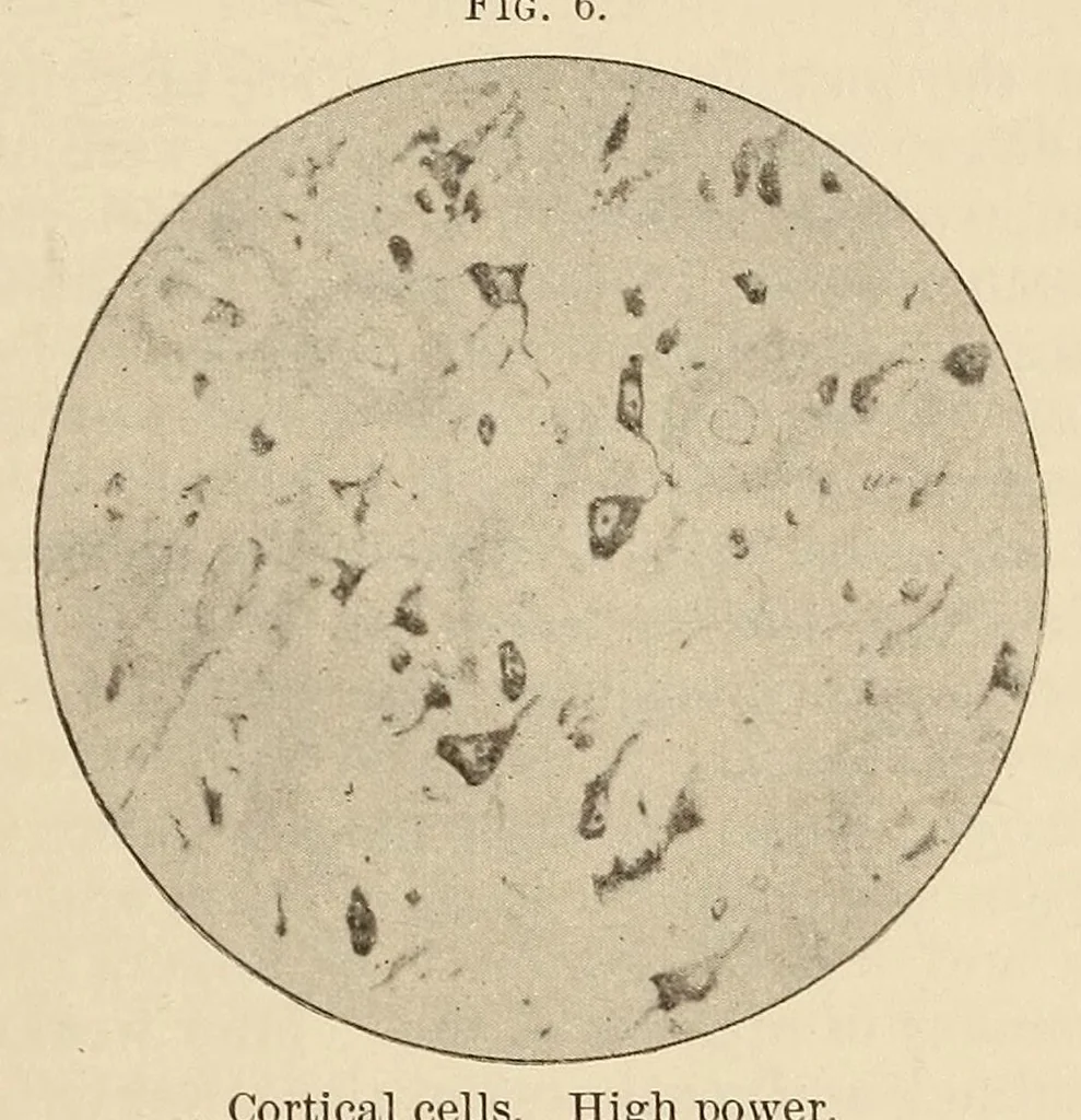 An illustration from The American journal of the medical sciences, 1827, leaf 903