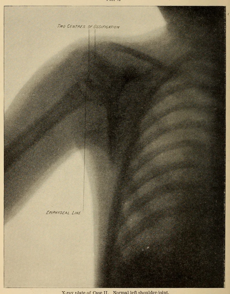 An illustration from The American journal of the medical sciences, 1827, leaf 200