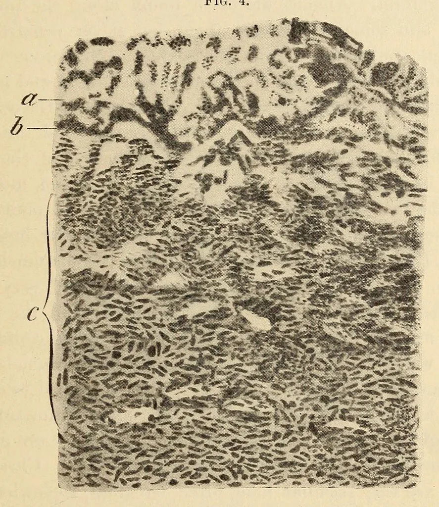 An illustration from The American journal of the medical sciences, 1827, leaf 553