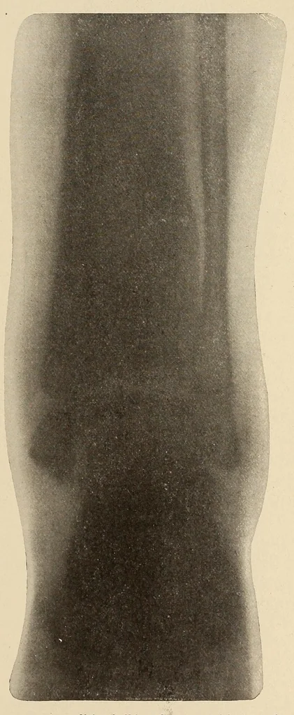 An illustration from The American journal of the medical sciences, 1827, leaf 57