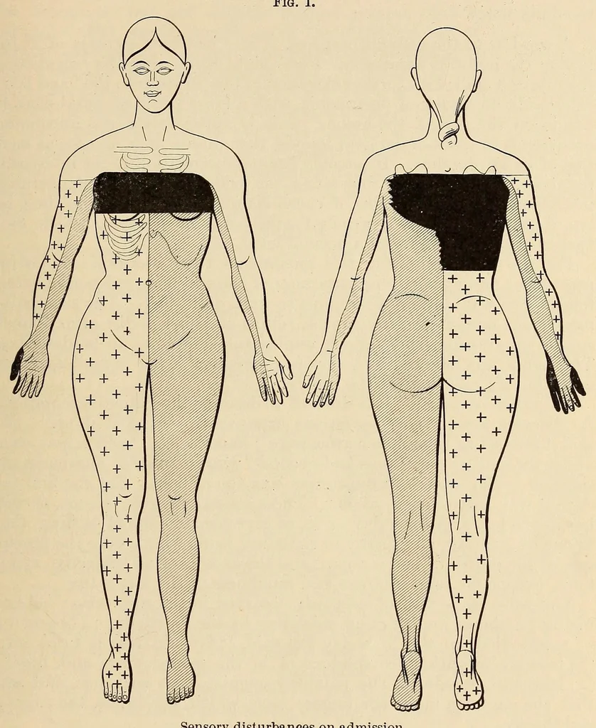 An illustration from The American journal of the medical sciences, 1827, leaf 881