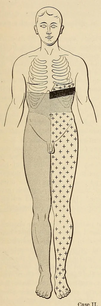 An illustration from The American journal of the medical sciences, 1827, leaf 905