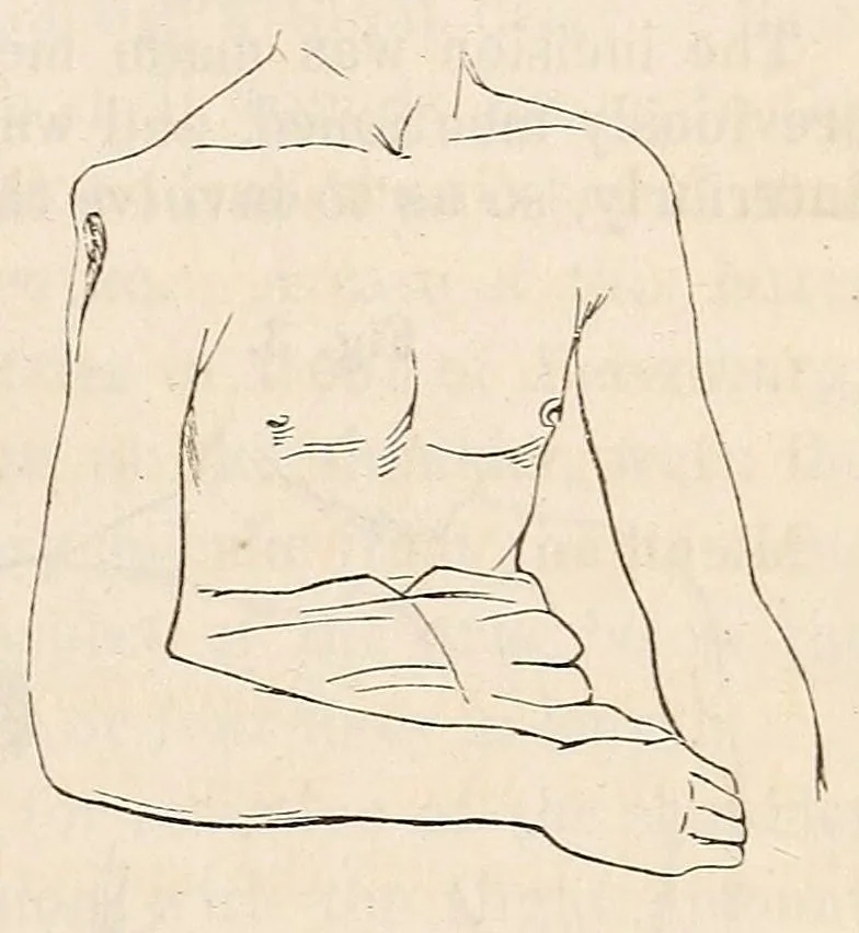 An illustration from The American journal of the medical sciences, 1827, leaf 357