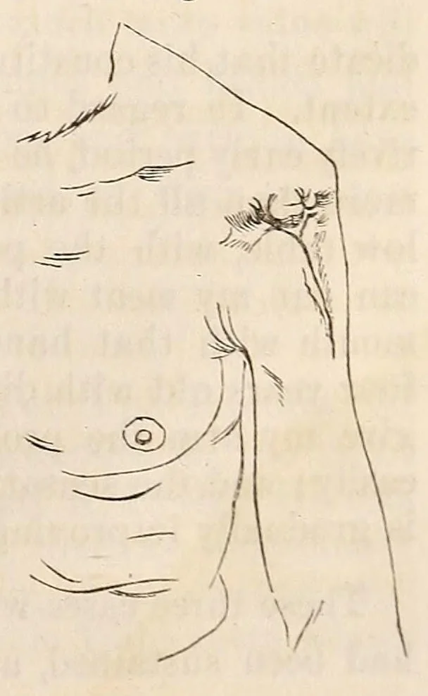 An illustration from The American journal of the medical sciences, 1827, leaf 357