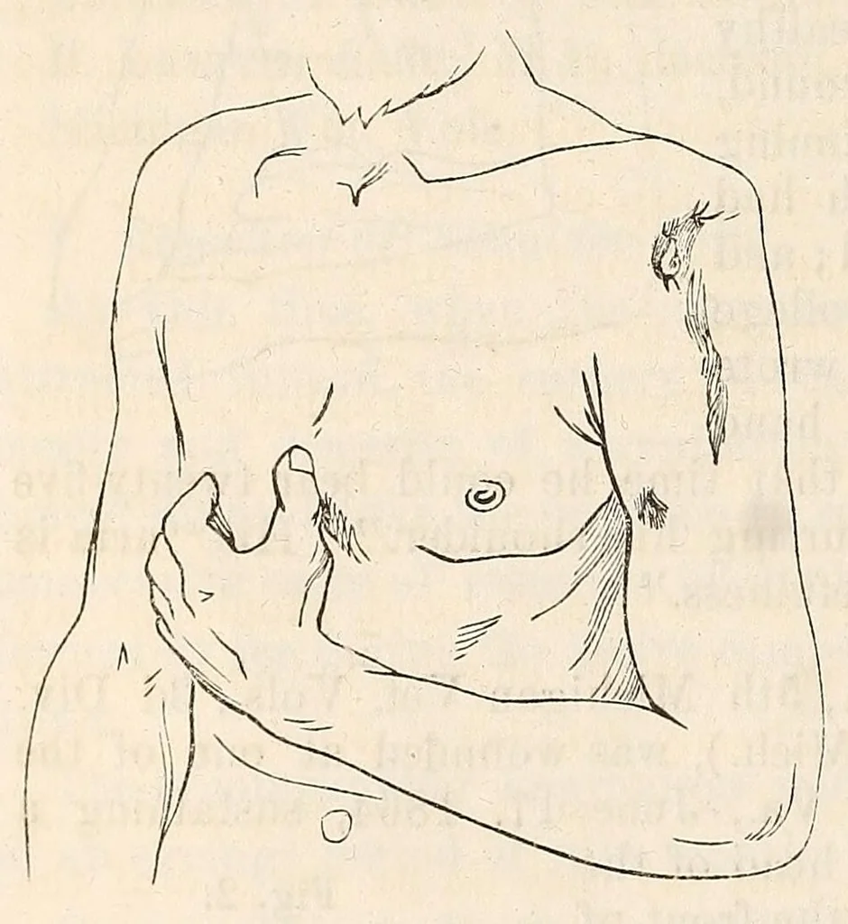 An illustration from The American journal of the medical sciences, 1827, leaf 358