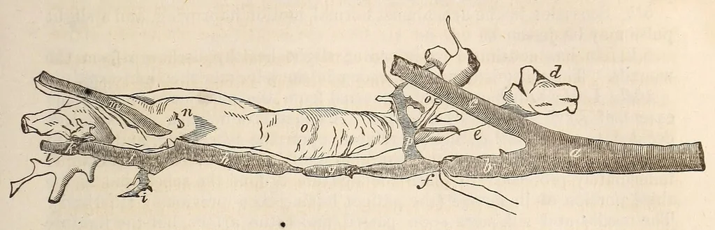 An illustration from The American journal of the medical sciences, 1827, leaf 389