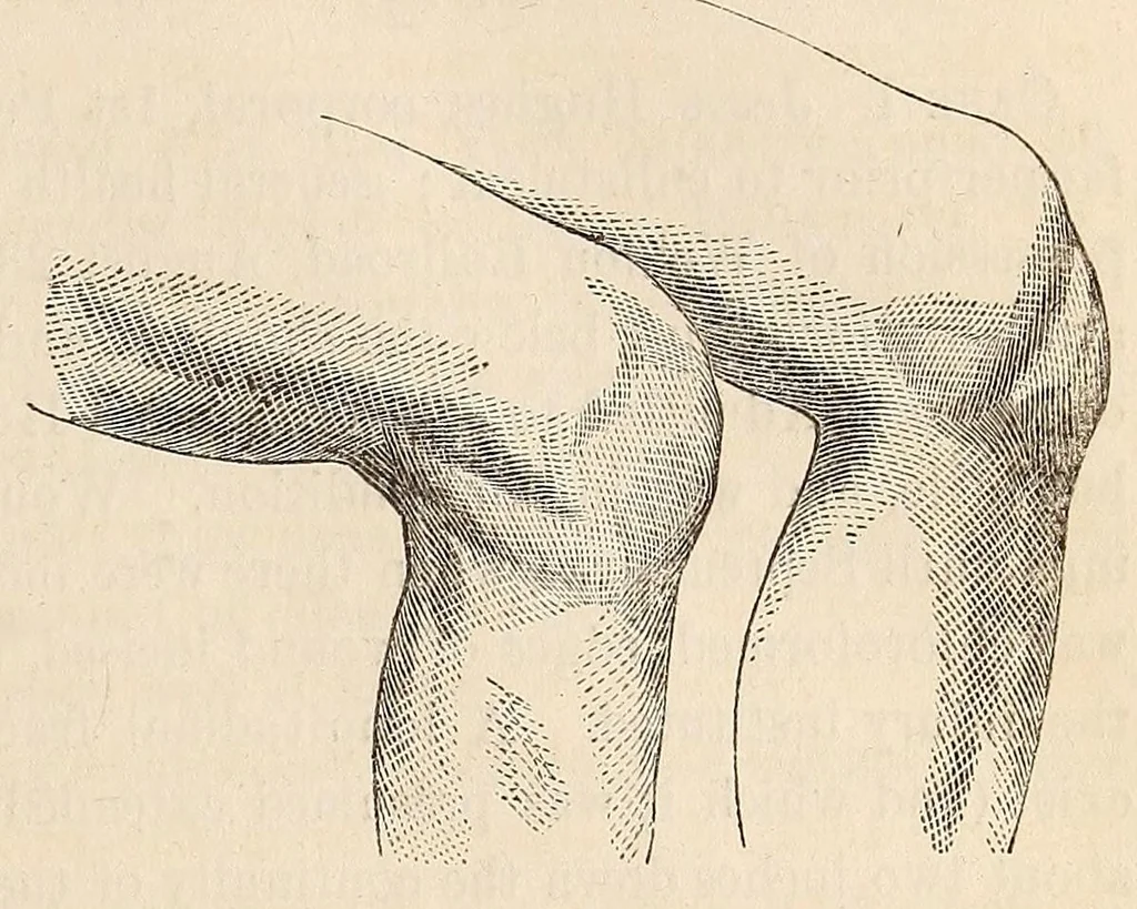 An illustration from The American journal of the medical sciences, 1827, leaf 85