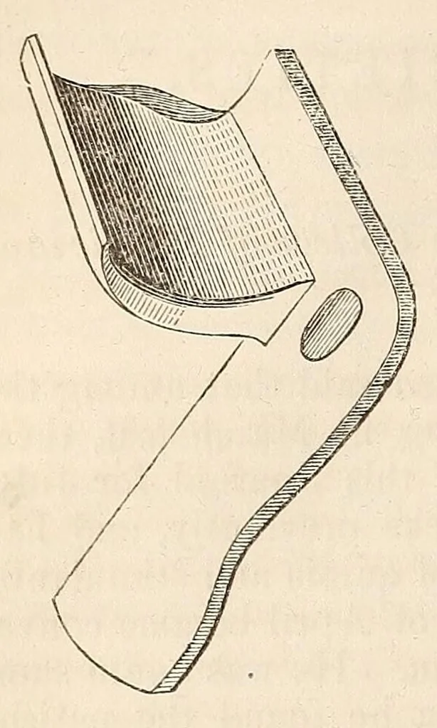 An illustration from The American journal of the medical sciences, 1827, leaf 96