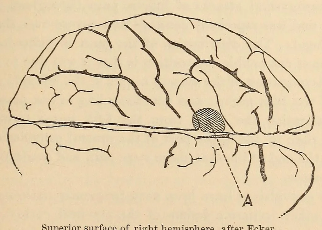 An illustration from The American journal of the medical sciences, 1827, leaf 177