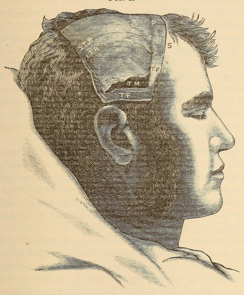 An illustration from The American journal of the medical sciences, 1827, leaf 409