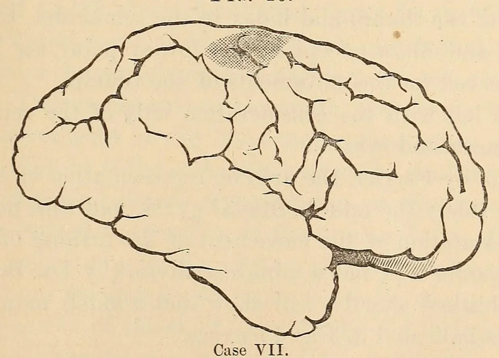 An illustration from The American journal of the medical sciences, 1827, leaf 425