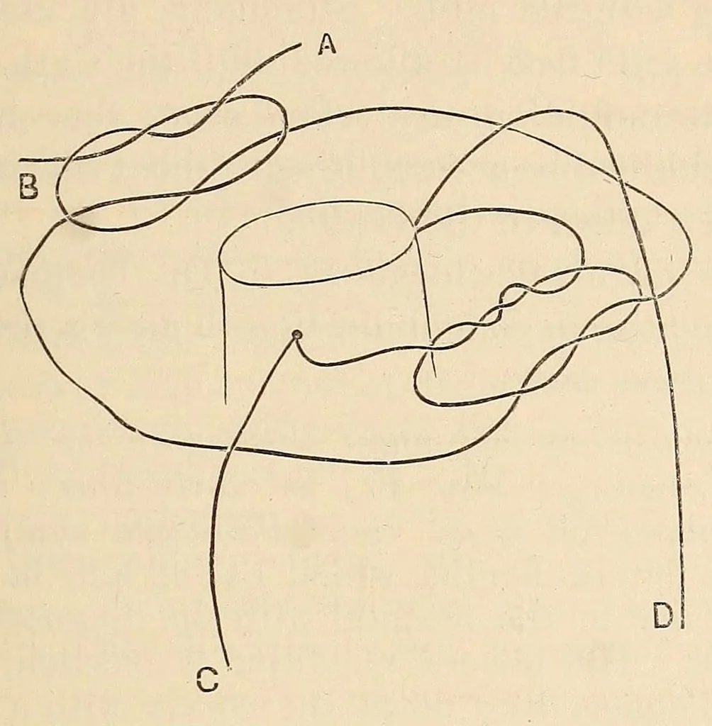 An illustration from The American journal of the medical sciences, 1827, leaf 531