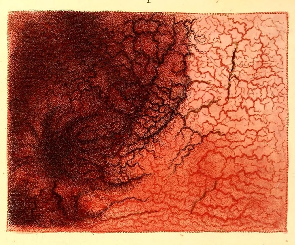 An illustration from The American journal of the medical sciences, 1827, leaf 296