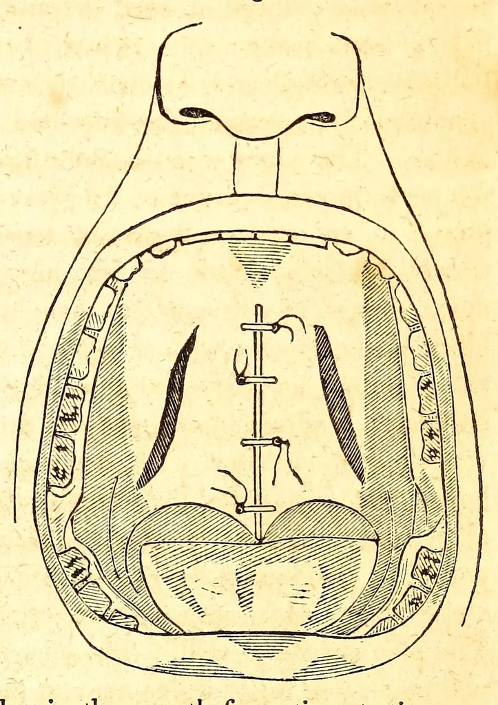 An illustration from The American journal of the medical sciences, 1827, leaf 77