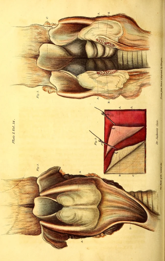 An illustration from The American journal of the medical sciences, 1827, leaf 306