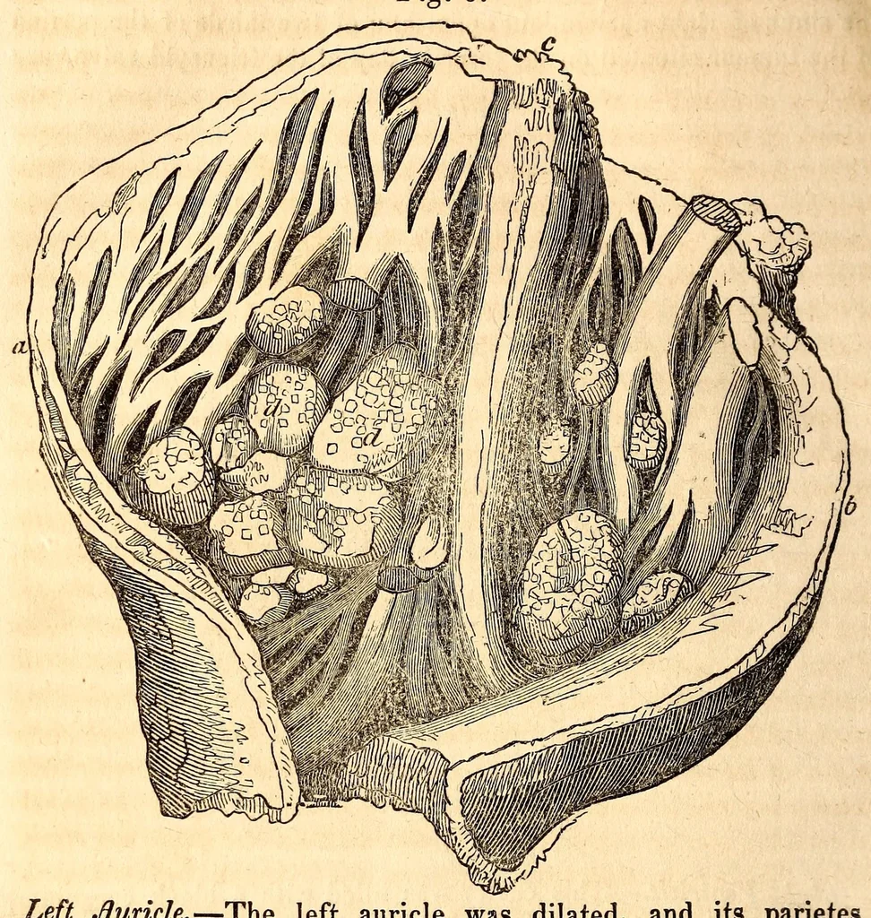 An illustration from The American journal of the medical sciences, 1827, leaf 314