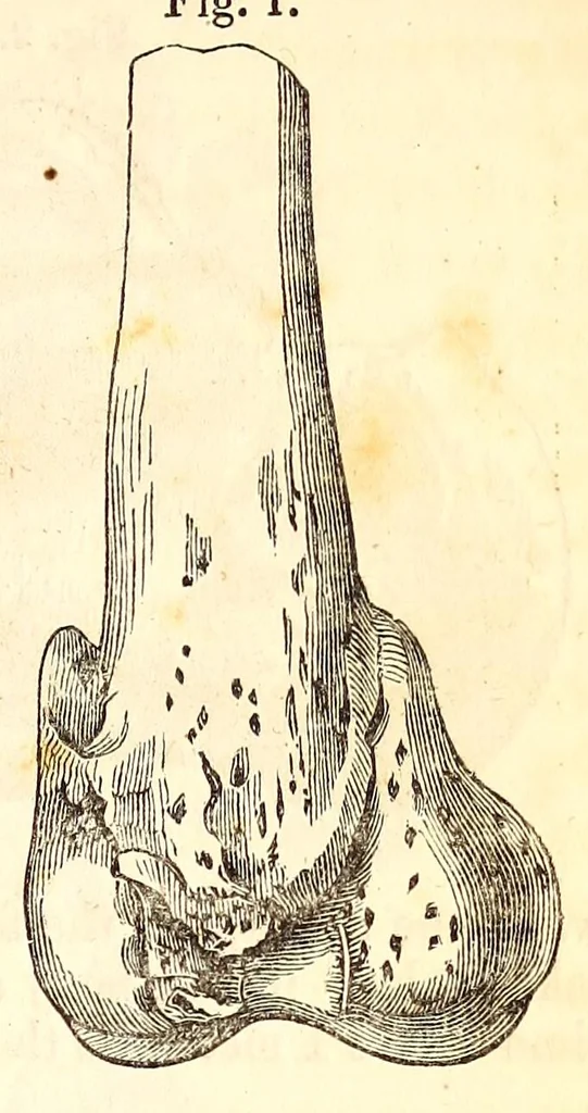 An illustration from The American journal of the medical sciences, 1827, leaf 127