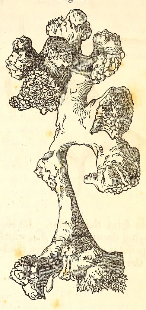 An illustration from The American journal of the medical sciences, 1827, leaf 129