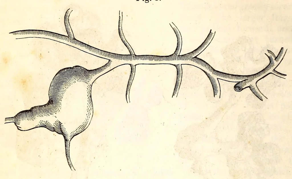 An illustration from The American journal of the medical sciences, 1827, leaf 130