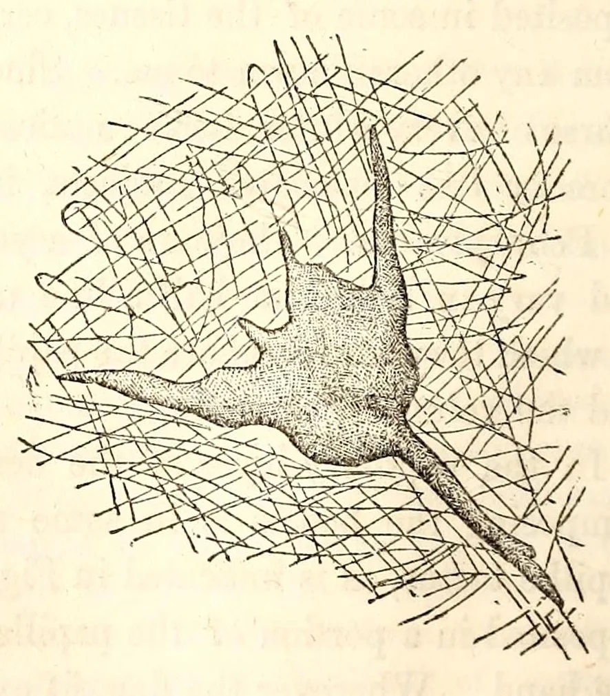 An illustration from The American journal of the medical sciences, 1827, leaf 100