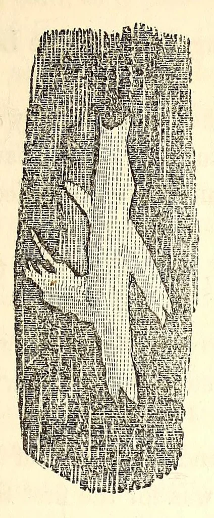 An illustration from The American journal of the medical sciences, 1827, leaf 101