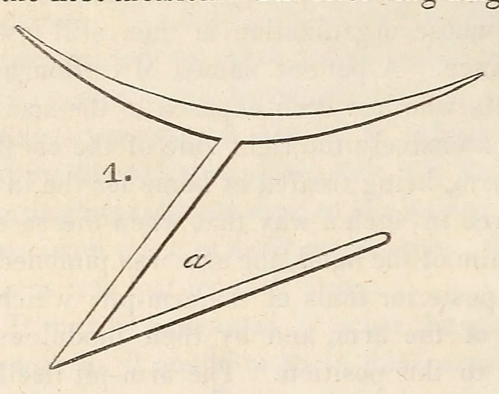 An illustration from The American journal of the medical sciences, 1827, leaf 110