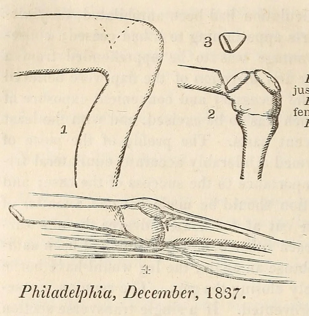 An illustration from The American journal of the medical sciences, 1827, leaf 344
