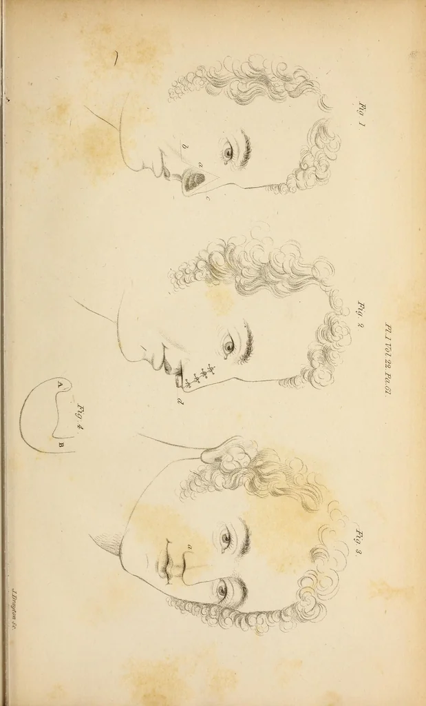 An illustration from The American journal of the medical sciences, 1827, leaf 19