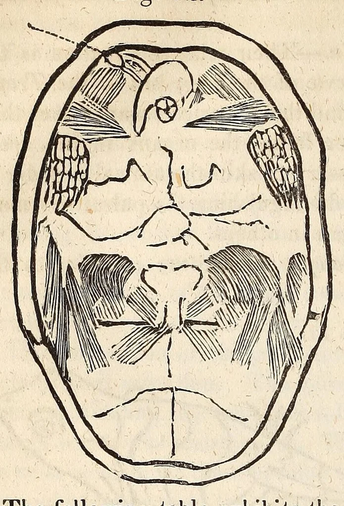 An illustration from The American journal of the medical sciences, 1827, leaf 398