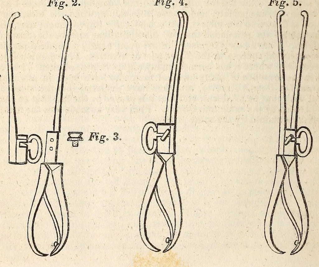 An illustration from The American journal of the medical sciences, 1827, leaf 516