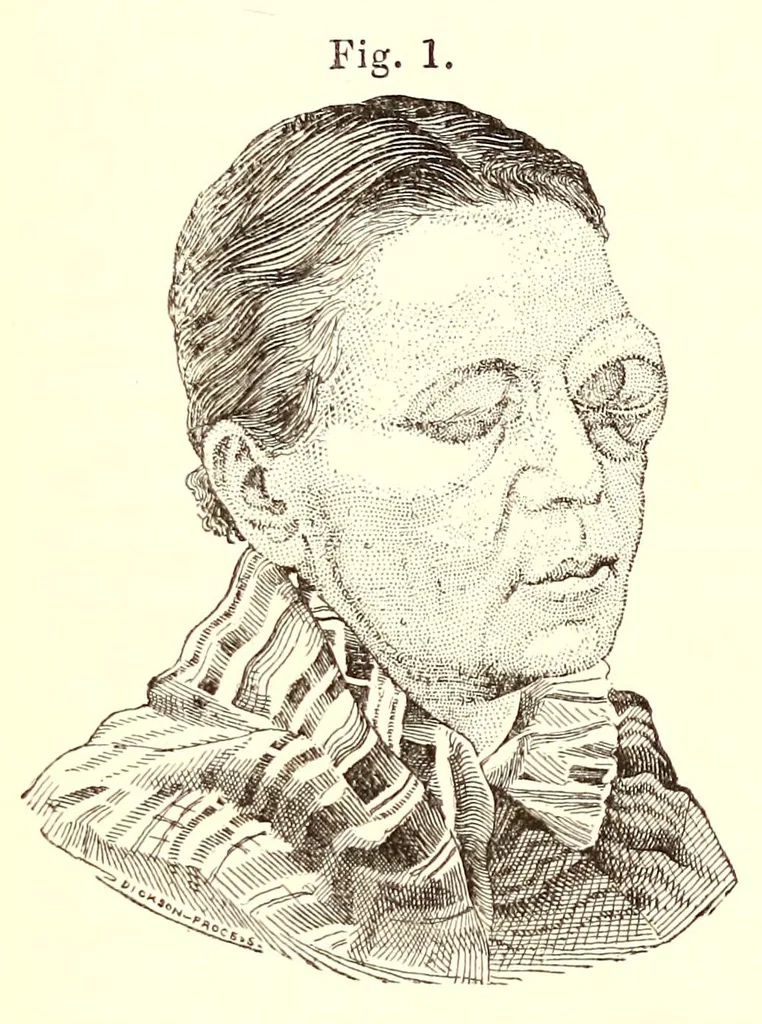 An illustration from The American journal of the medical sciences, 1827, leaf 100