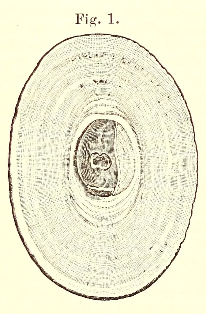 An illustration from The American journal of the medical sciences, 1827, leaf 260