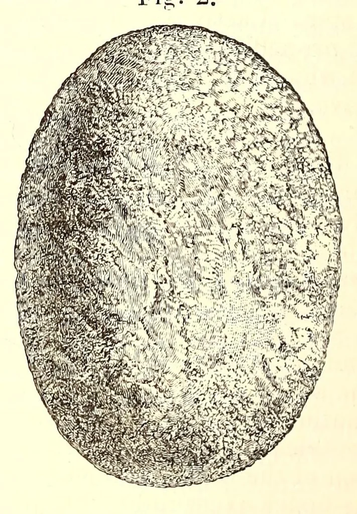 An illustration from The American journal of the medical sciences, 1827, leaf 260