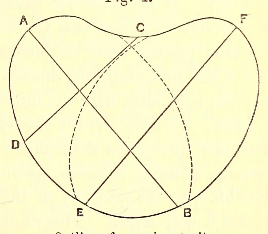 An illustration from The American journal of the medical sciences, 1827, leaf 75