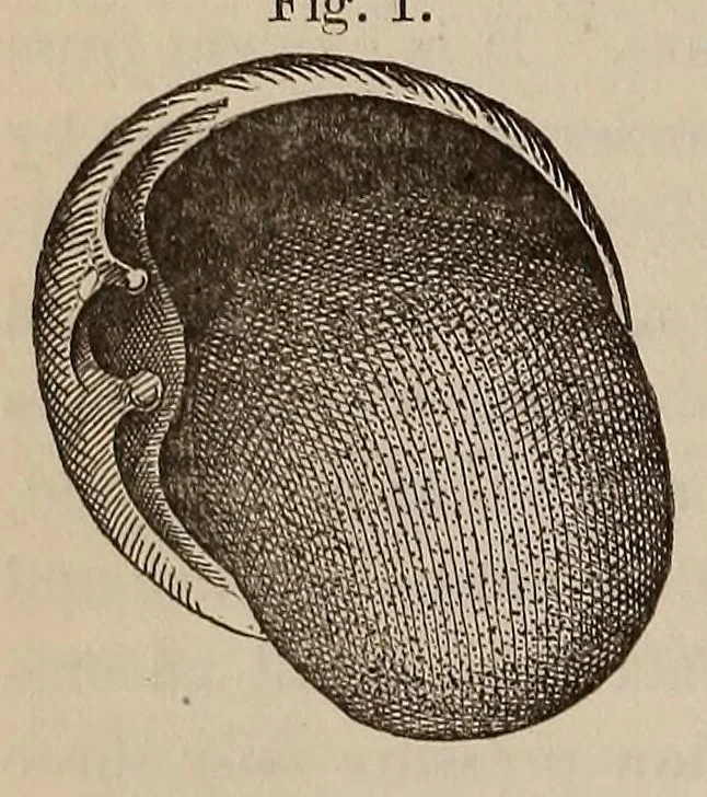 An illustration from The American journal of the medical sciences, 1827, leaf 146