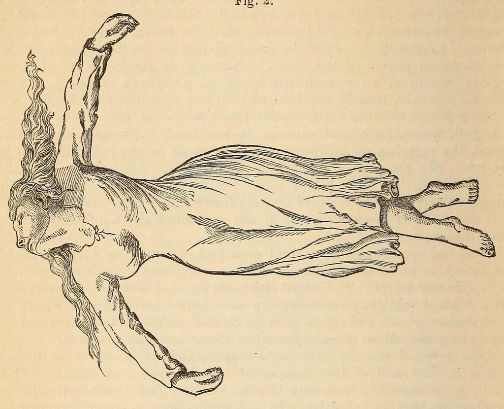 An illustration from The American journal of the medical sciences, 1827, leaf 392