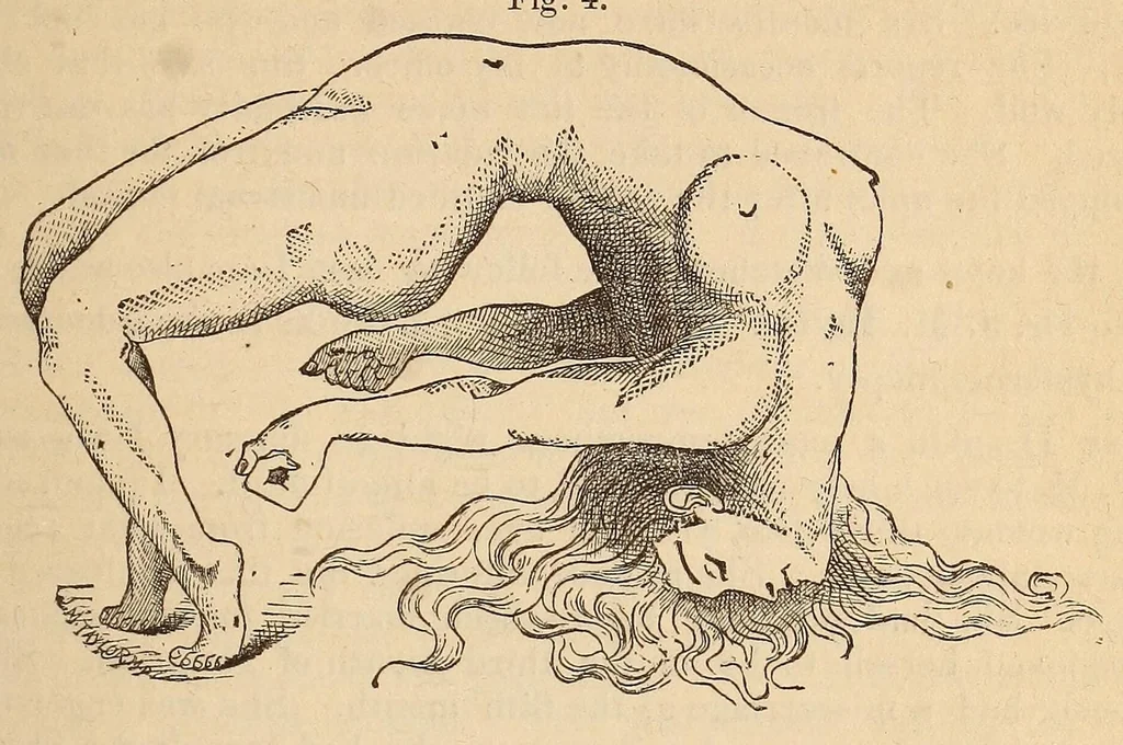 An illustration from The American journal of the medical sciences, 1827, leaf 393