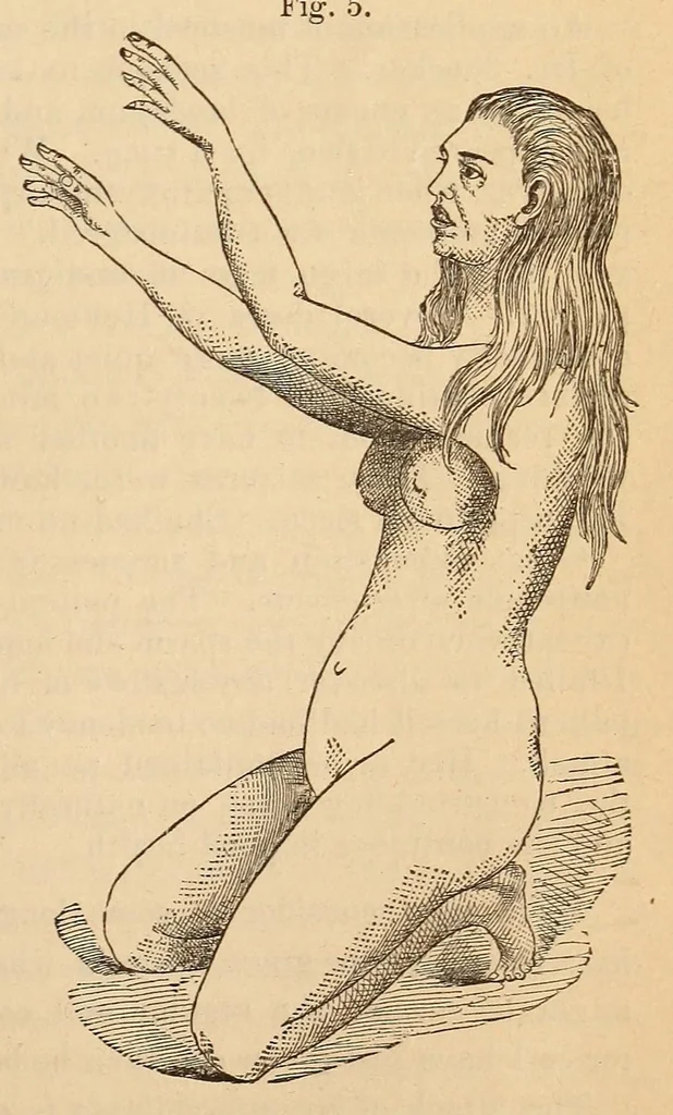 An illustration from The American journal of the medical sciences, 1827, leaf 395