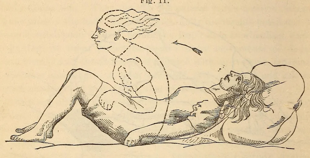 An illustration from The American journal of the medical sciences, 1827, leaf 408